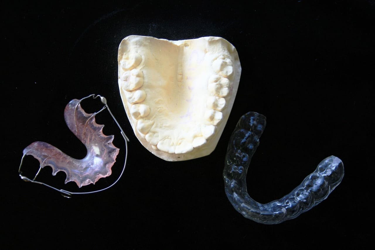 Implantes dentales y sus cambios a lo largo de los años