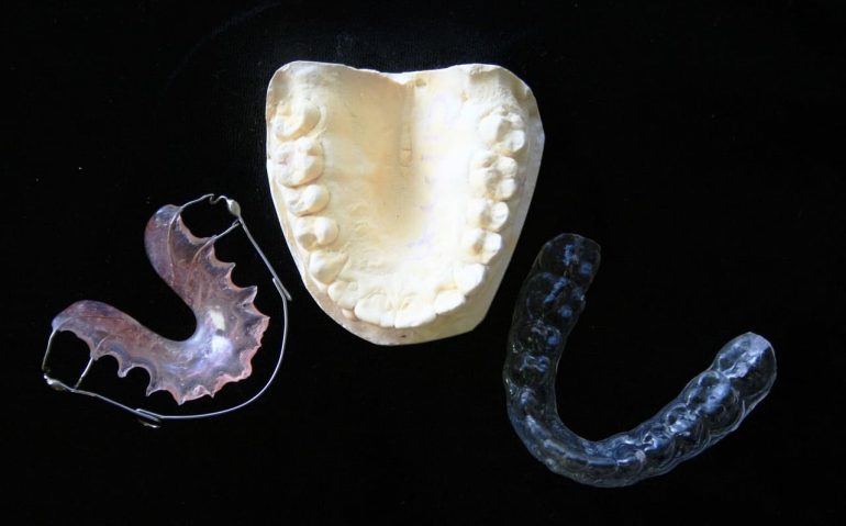 orthodontic-315784_1280 (1)
